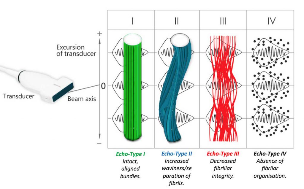 Ultrasound Tissue Characterization